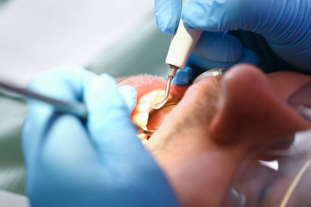 Best Root Canal Emergency Dentist  in Jackson, OH