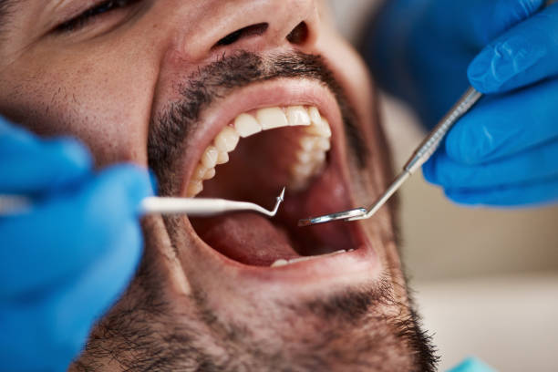 Best Teeth Whitening  in Jackson, OH