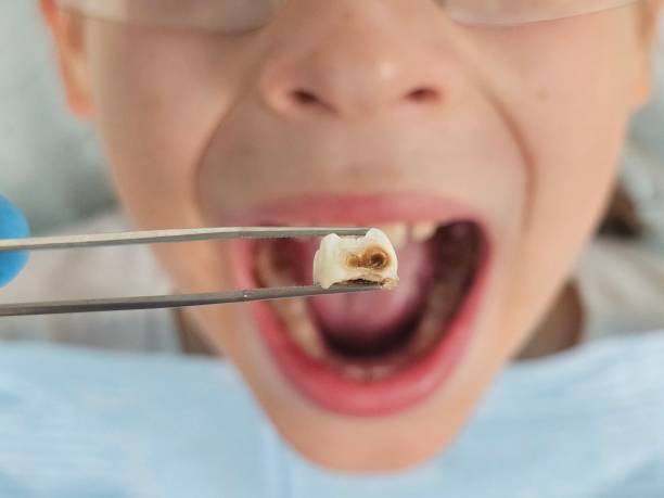 Best Urgent Tooth Repair  in Jackson, OH