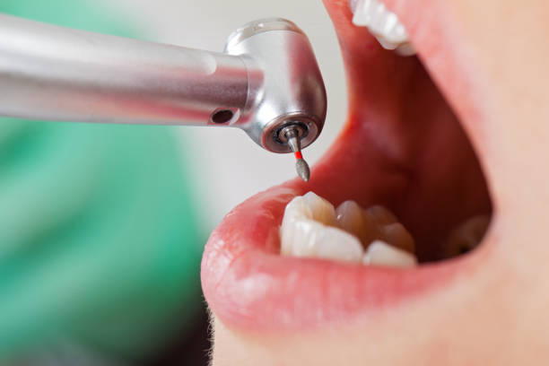 Best Emergency Gum Pain Relief  in Jackson, OH